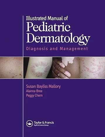 Illustrated Manual of Pediatric Dermatology: Diagnosis and Management (Color)